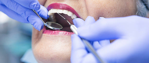Best Emergency Dentist for Lost Fillings or Crowns in Oakland, OK